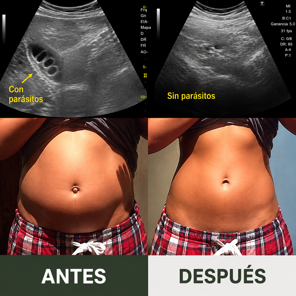 Pack Completo de Aceite de Ricino