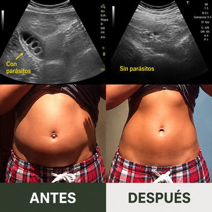 Pack Completo de Aceite de Ricino